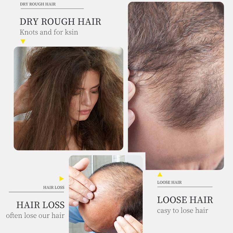 Рост волос Сыворотка для волос Укрепляет волосы Уменьшение выпадения волос Уход за кожей головы Имбирное масло