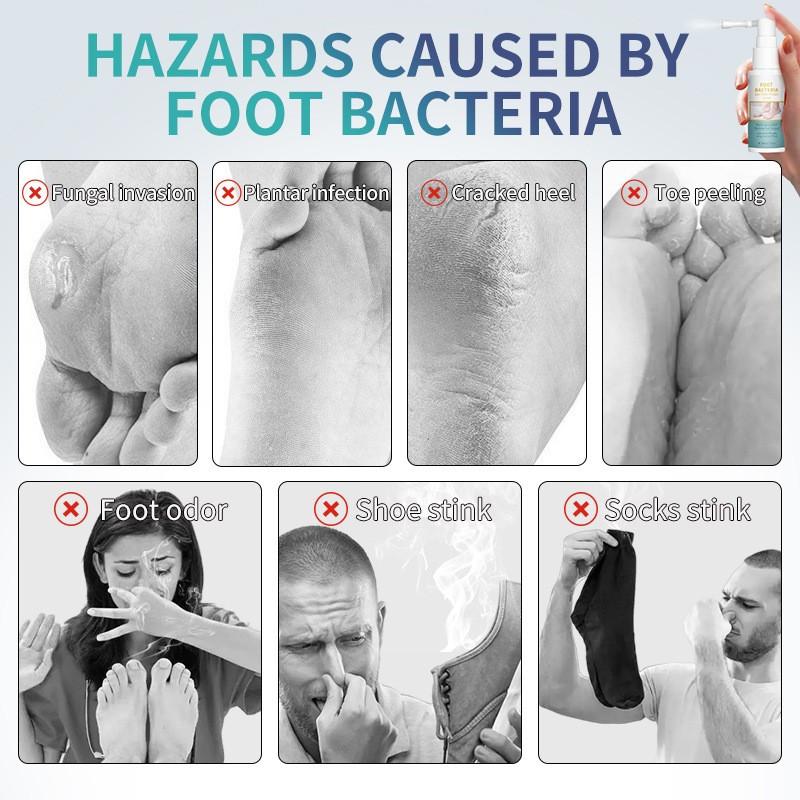 Быстродействующее средство для ухода за ногами при грибке стопы, Натуральный дезодорант для ухода, Освежающий и дезинфицирующий спрей для женщин, 20 мл