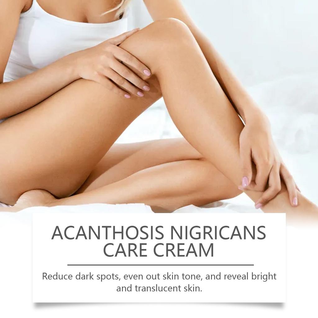 Крем Acanthosis Nigricans, крем для подмышек, крем-корректор темного цвета для удаления гиперпигментации, крем для шеи, лодыжек.