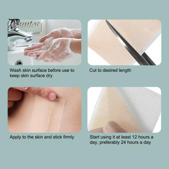 Силиконовые пластыри для рубцов, рулон ленты для рубцов, профессиональные мягкие полоски для рубцов после хирургических операций, келоидные рубцы, лечение угревой сыпи, силиконовый гелевый пластырь