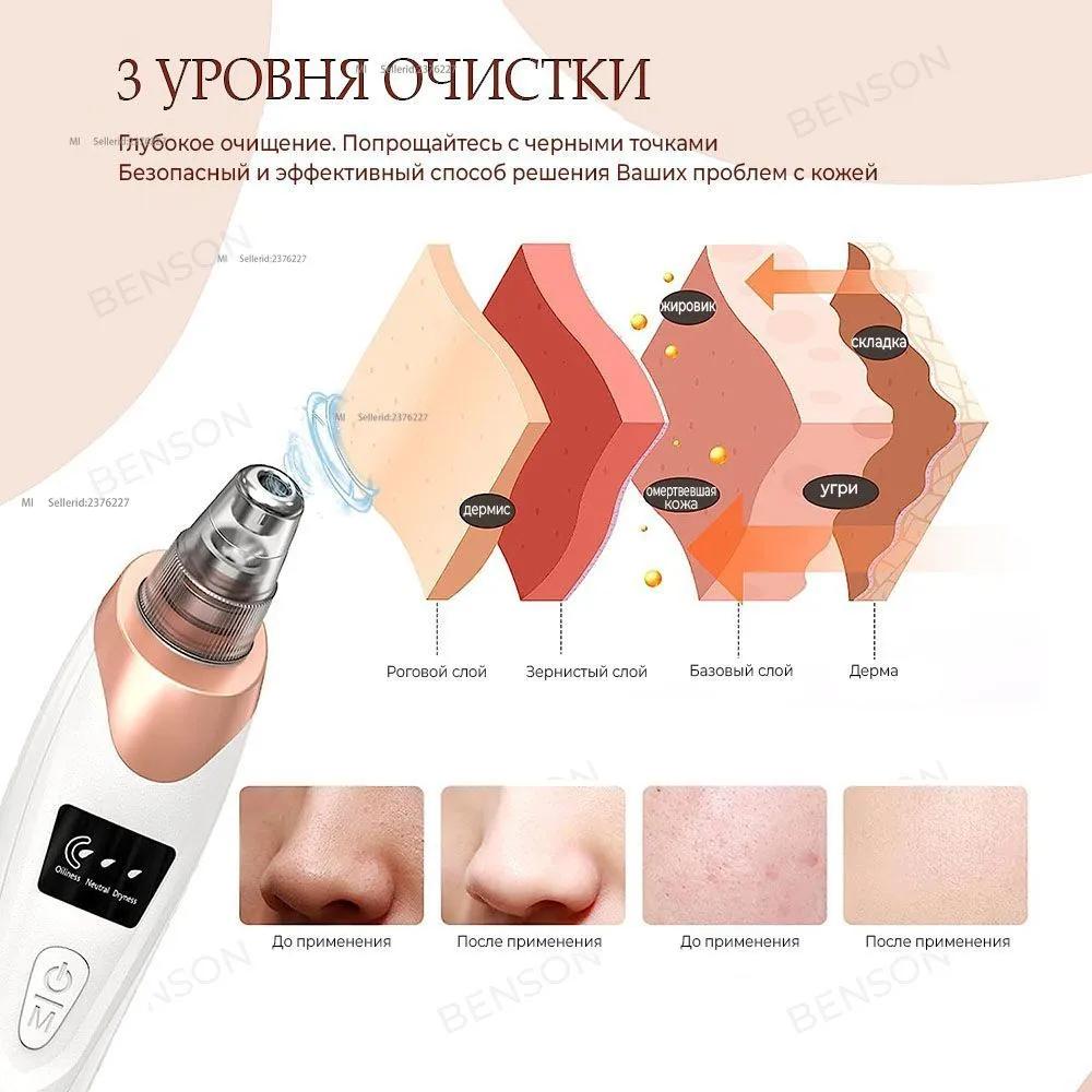 Вакуумный инструмент для очистки пор от черных точек на лице. Косметический очиститель, использующий 5 видов наполнителей для очистки лица.