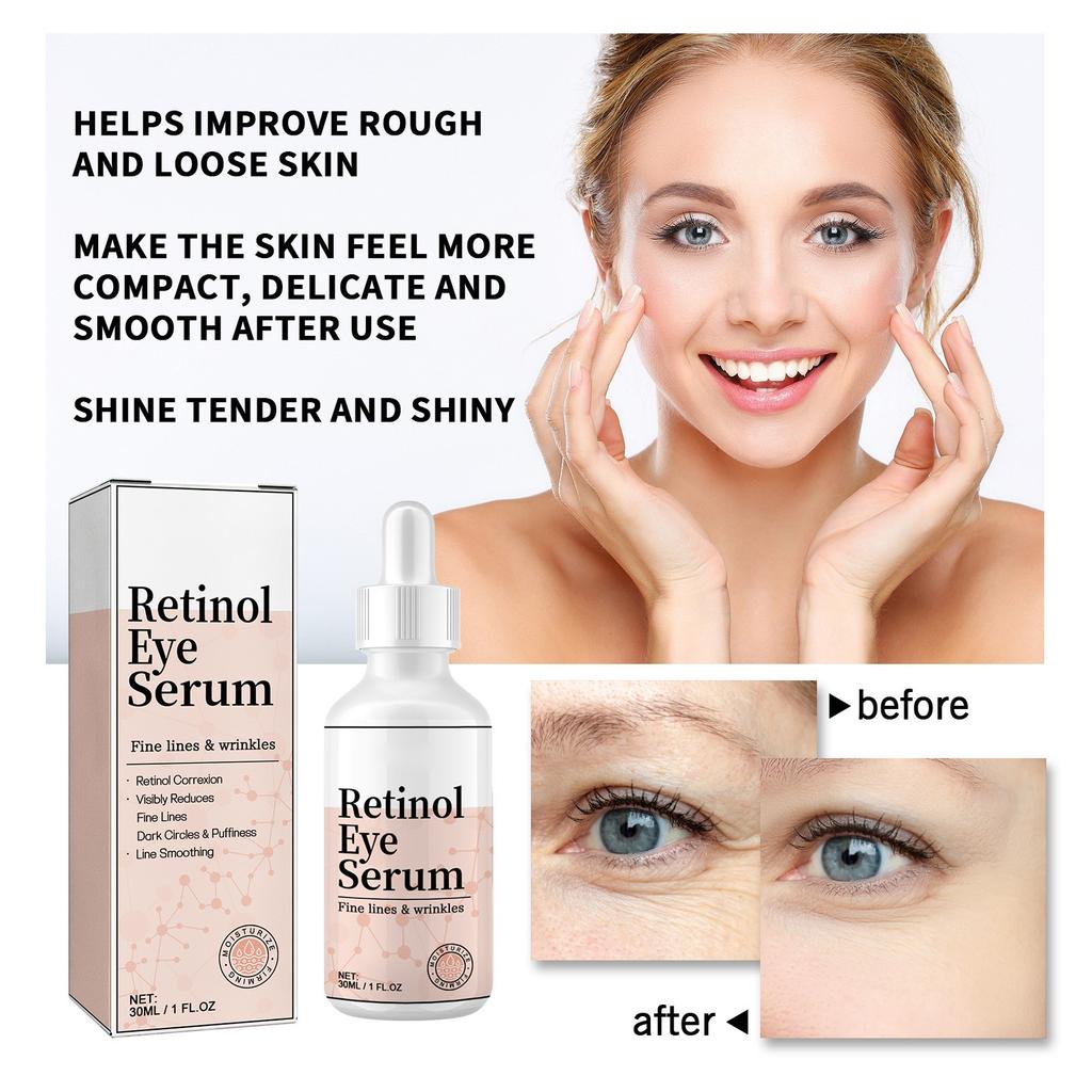 Крем для глаз с ретинолом, разглаживает мелкие морщинки вокруг глаз, убирает мешки под глазами, черные круги, подтягивает и увлажняет кожу вокруг глаз, 30 мл