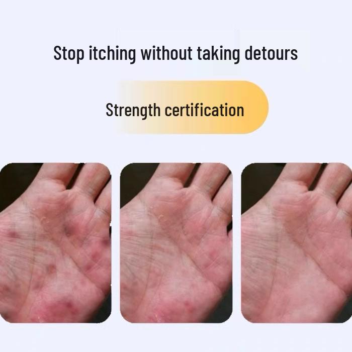 Крем-король грибов Юньнань для снятия зуда кожи, для сухих, потрескавшихся пяток и предотвращения огрубения кожи