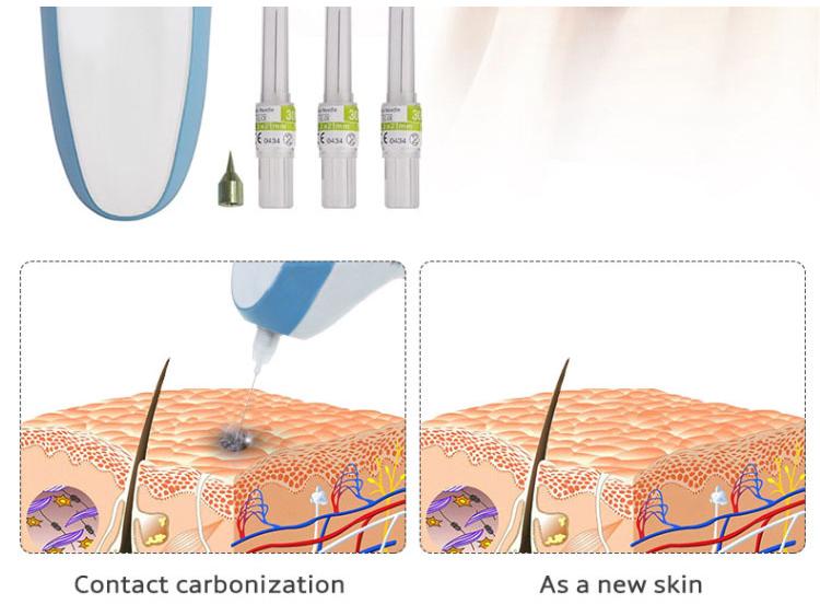 Перезаряжаемая Волшебная Ручка для удаления веснушек и родинок - Плазменный Косметологический Аппарат с Магнитной Левитацией