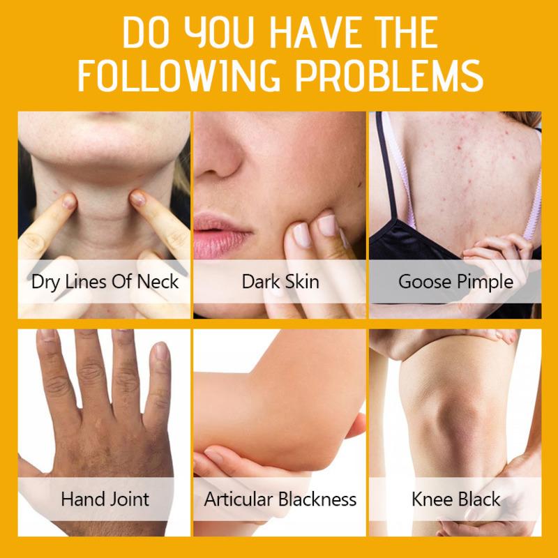 Disaar 100 г/шт. Изысканный лосьон-пилинг для девочек, отбеливающий, удаляющий омертвевшую кожу, питательные кремы для тела, эффективно смягчающий кератиновый лосьон