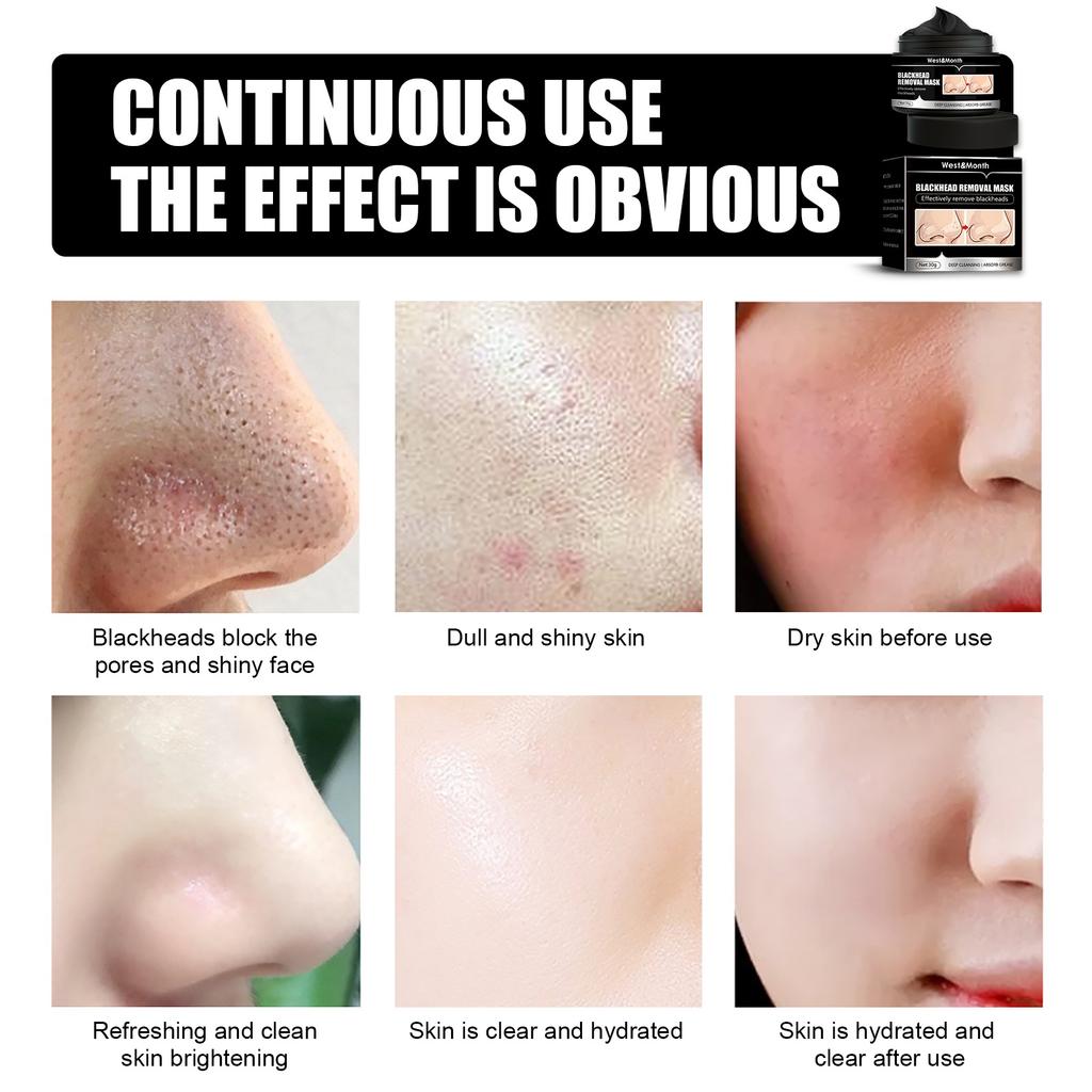 Глубоко очищающая, сужающая поры носа, увлажняющая маска с бамбуковым углем для удаления черных точек и прыщей