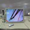 HD Digital Skin Analyzer Professional Hair Scalp Camera Detector Hair Follicle Oil Moisture Test Device 15inch