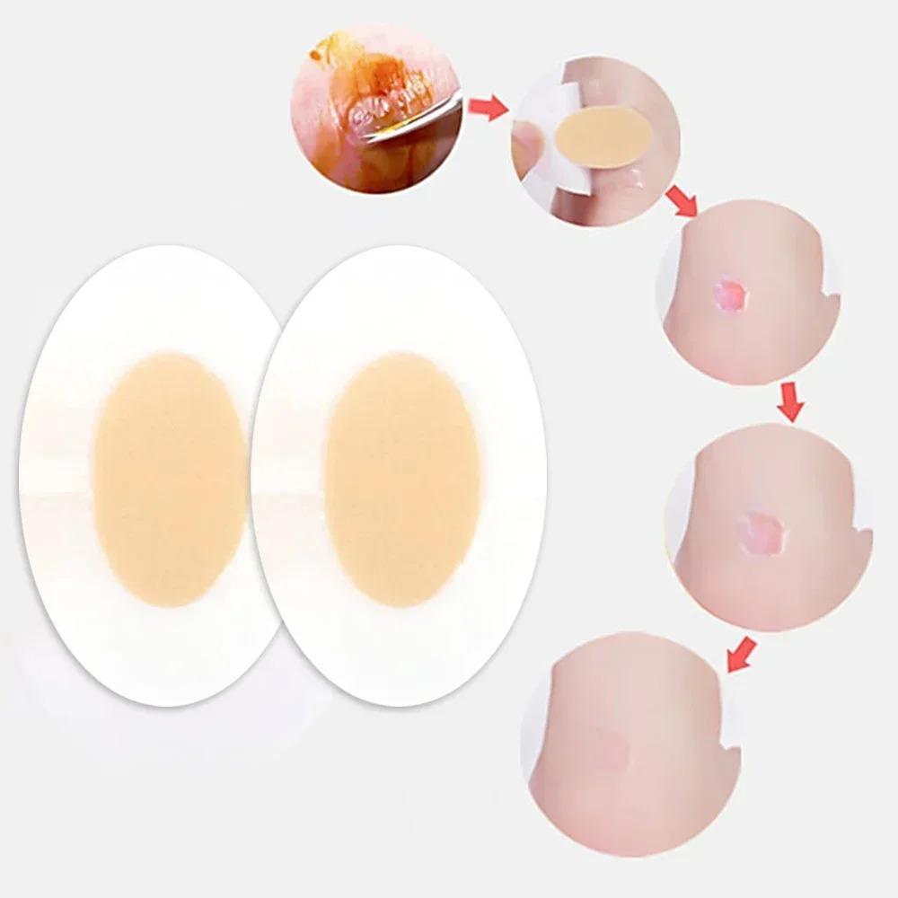 Гелевая защита пятки, пластыри для ног, клейкие волдыри, подушечки для пятки, наклейки для обуви, облегчение боли, пластырь, подушка для ухода за ногами, ручка