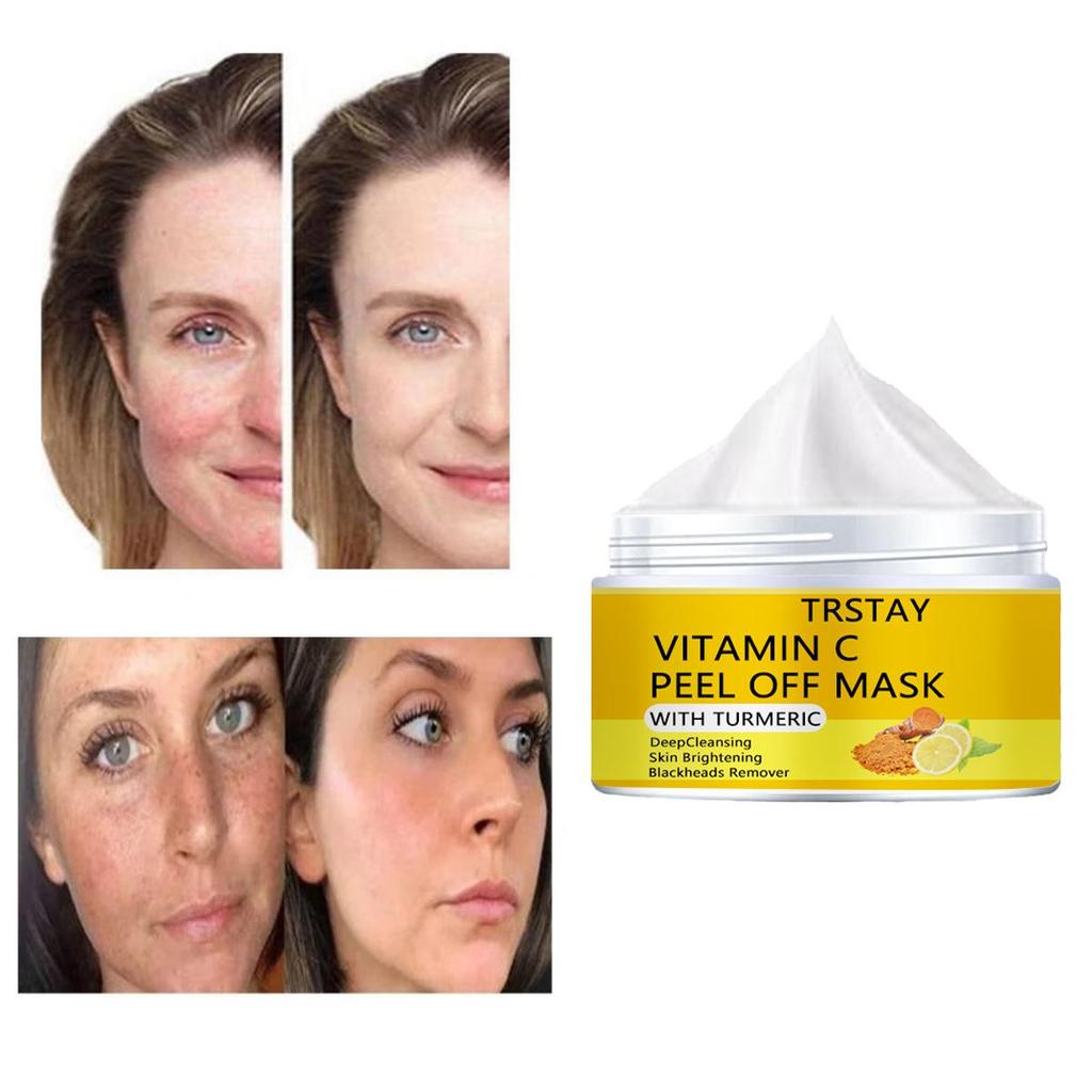 Осветляющий и полупрозрачный крем для кожи с пигментными пятнами, мягкое увлажнение без раздражения, уменьшает мелкие морщины, увлажняет кожу и улучшает состояние поврежденной кожи.