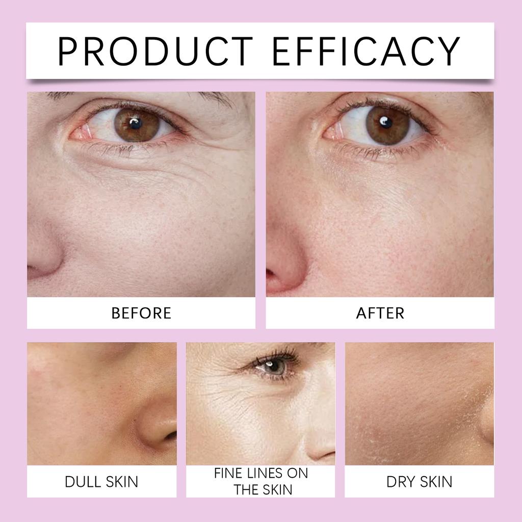 Facial Patches Reduce Wrinkles And Fine Lines, Firm The Skin And Deeply Nourish The Skin