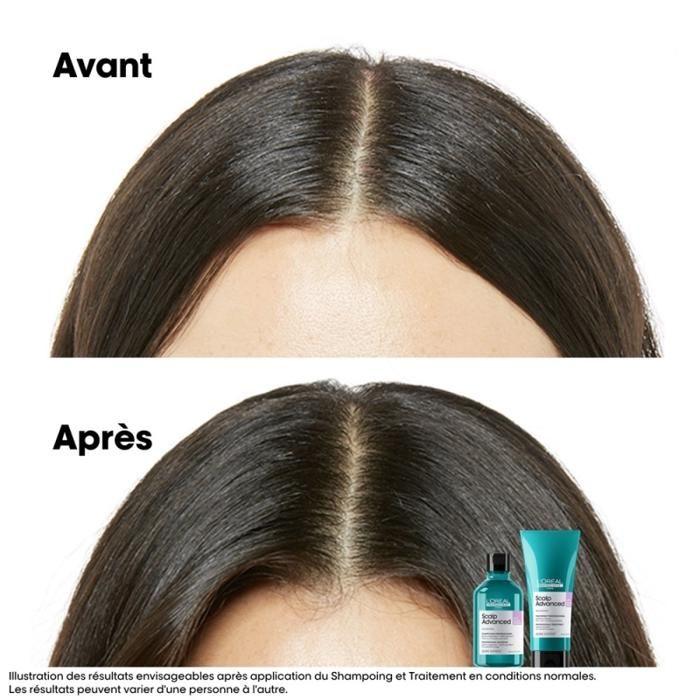 L#039;L'Oréal Professionnel Série Expert Шампунь Scalp Advanced Recharge Против Дискомфорта 500мл
