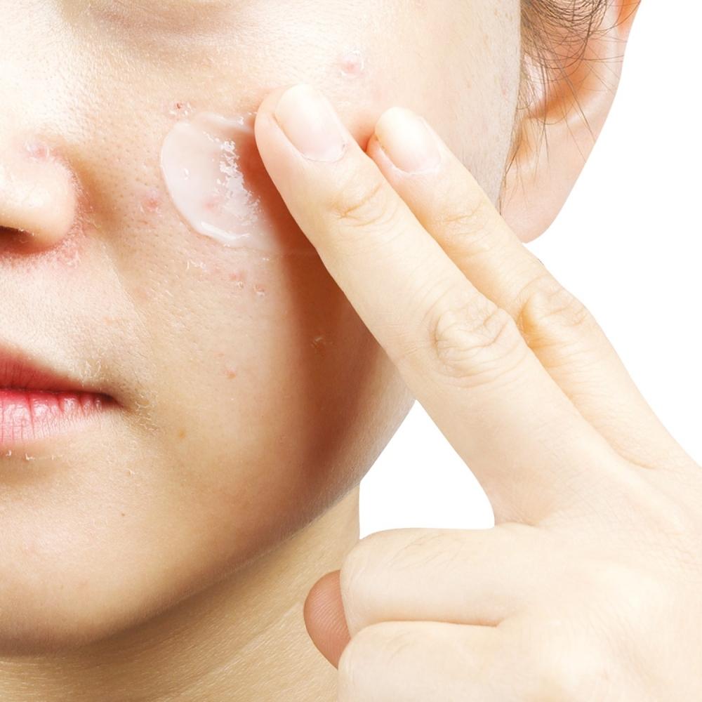 Yadah Skin AnTi T moisTurizing Cream