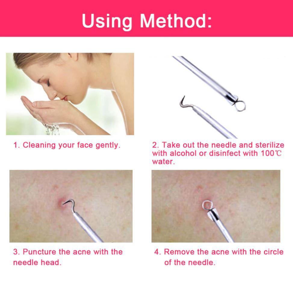 A 5-piece Acne Needle Set Facial Beauty Pick Acne Acne Removal Beauty Makeup Tool Blackhead Acne Needle