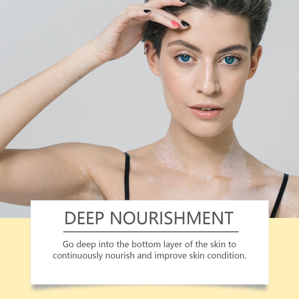 Promote Metabolism, Reduce Inflammation, And Help Reduce The Area Of Spots.help Reduce Pigment In Areas Of Spots.