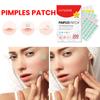 200 шт. наклейка на пластырь от прыщей, водостойкий инструмент для удаления прыщей, средство для удаления пятен, маска для лица, уход за кожей, скрытые прыщи