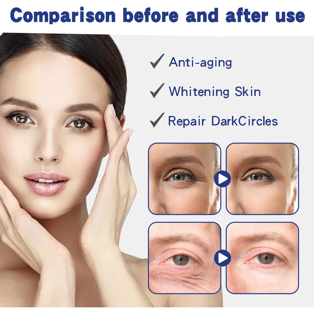 Firming Eye Cream To Lighten Fine Lines At the Corners of the Eyes, Repair Dark Circles On the Skin Around the Eyes, and Provide Eye Care