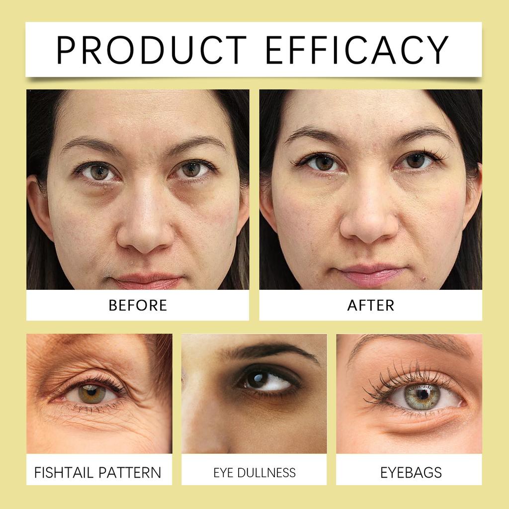 Гель для осветления темных кругов вокруг глаз, улучшения окружности глаз, улучшения тусклости, разглаживания напряжений кругов под глазами, 50 г