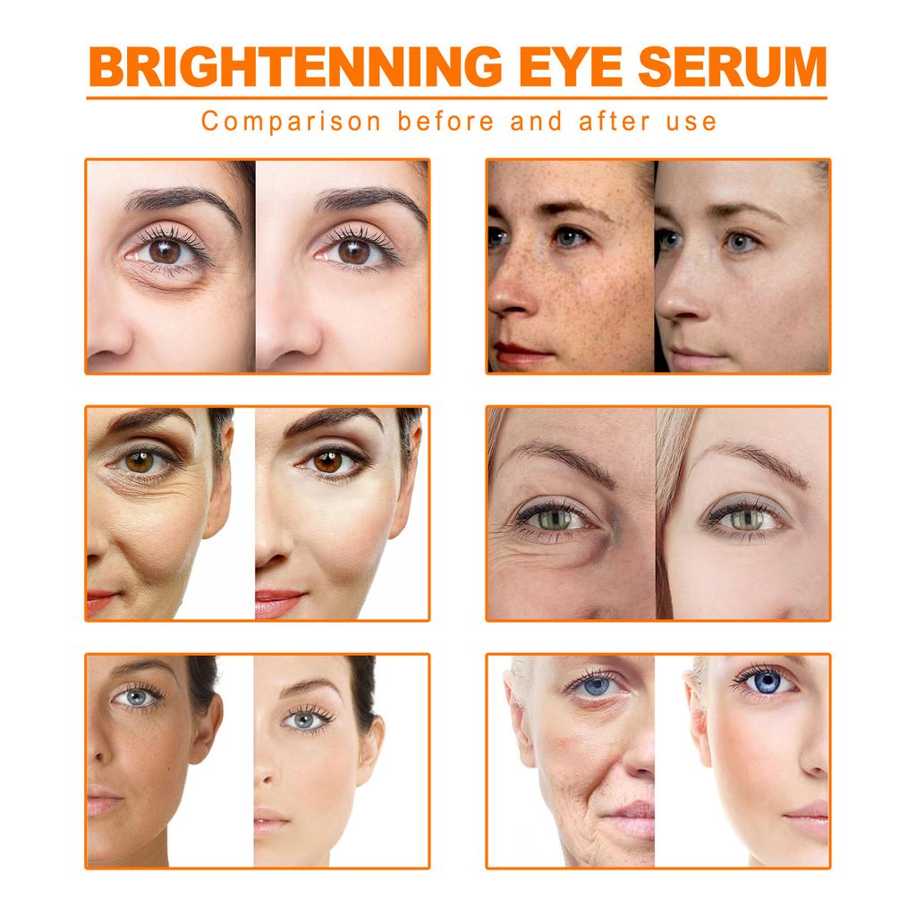 Turmeric Essential Oil, Facial Skin Fading Spot Firming Anti-Wrinkle Lifting Skin Care Moisturizing Oil