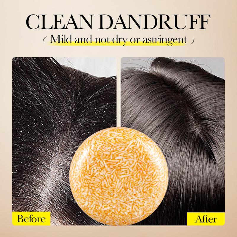 Мыло с имбирем и горцем Шампунь Мыло холодной обработки Мыло для волос Шампунь для волос Чистые растительные шампуни для волос Уход за волосами