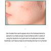SOME BY MI AHA, BHA, PHA 30-дневная очищающая пенка Miracle Acne Clear Foam Mini