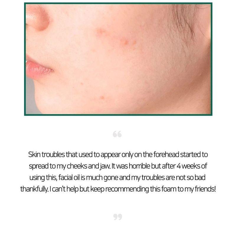 SOME BY MI AHA, BHA, PHA 30-дневная очищающая пенка Miracle Acne Clear Foam Mini