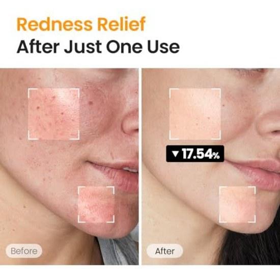 SKINFOOD Carrot Toner Pad Carotene Calming Water Korean Skincare Wipe-off Lotion (250g 60 sheets)