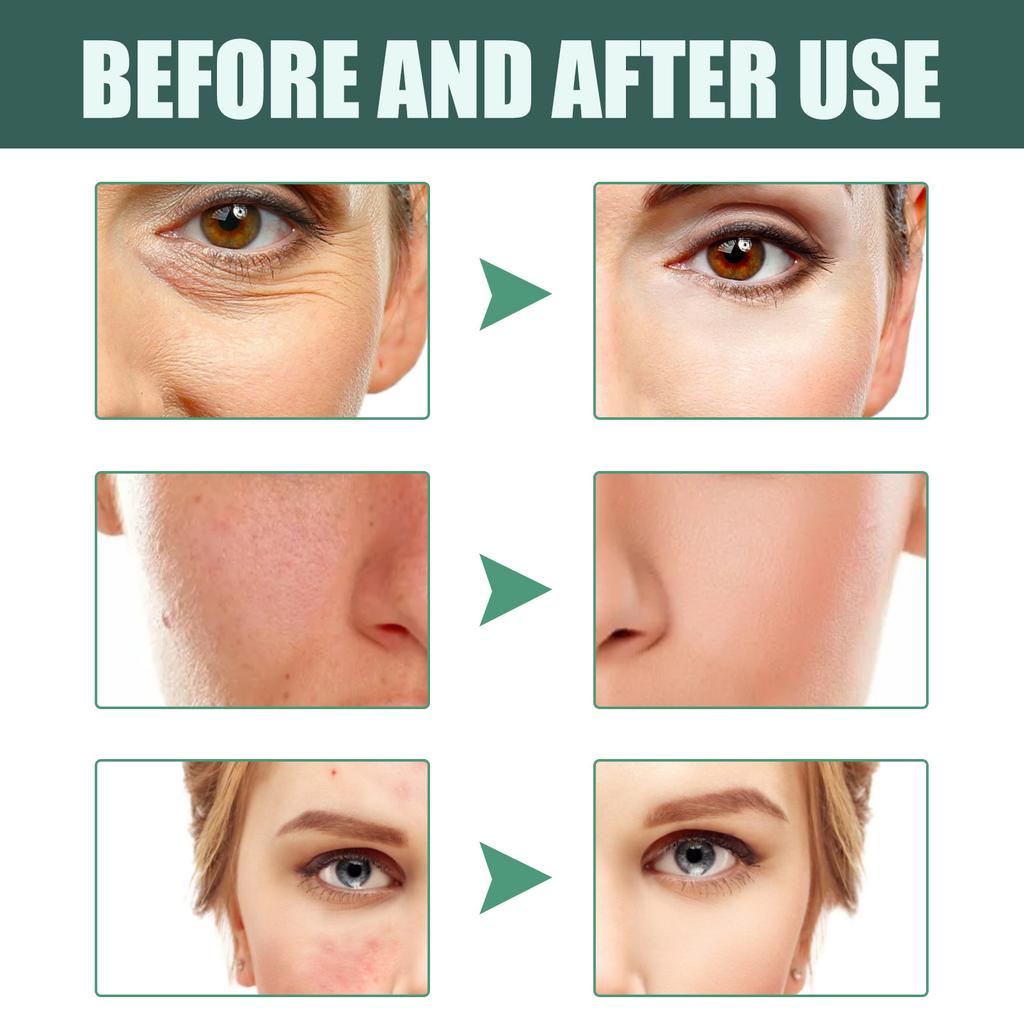 Экстракт ретинола, омолаживающее средство для сужения пор, разглаживает мелкие морщины, осветляет, укрепляет и освежает кожу лица