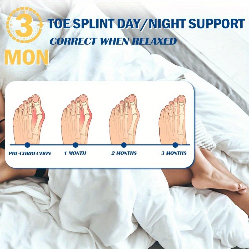 1 пара, коррекция вальгусной деформации, педикюр, выпрямитель для носков, сепаратор для большого пальца ноги, система коррекции шин, устройство для ухода за ногами