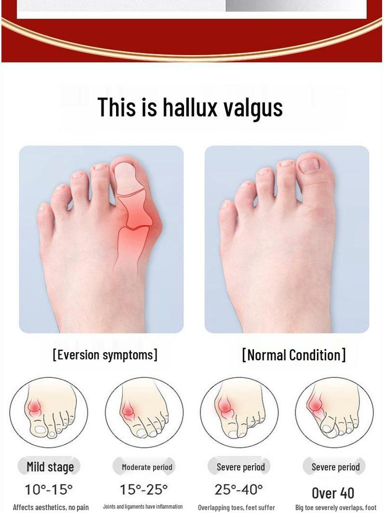 Трансграничные носки-корректоры косточки большого пальца стопы с разделителем для двух пальцев