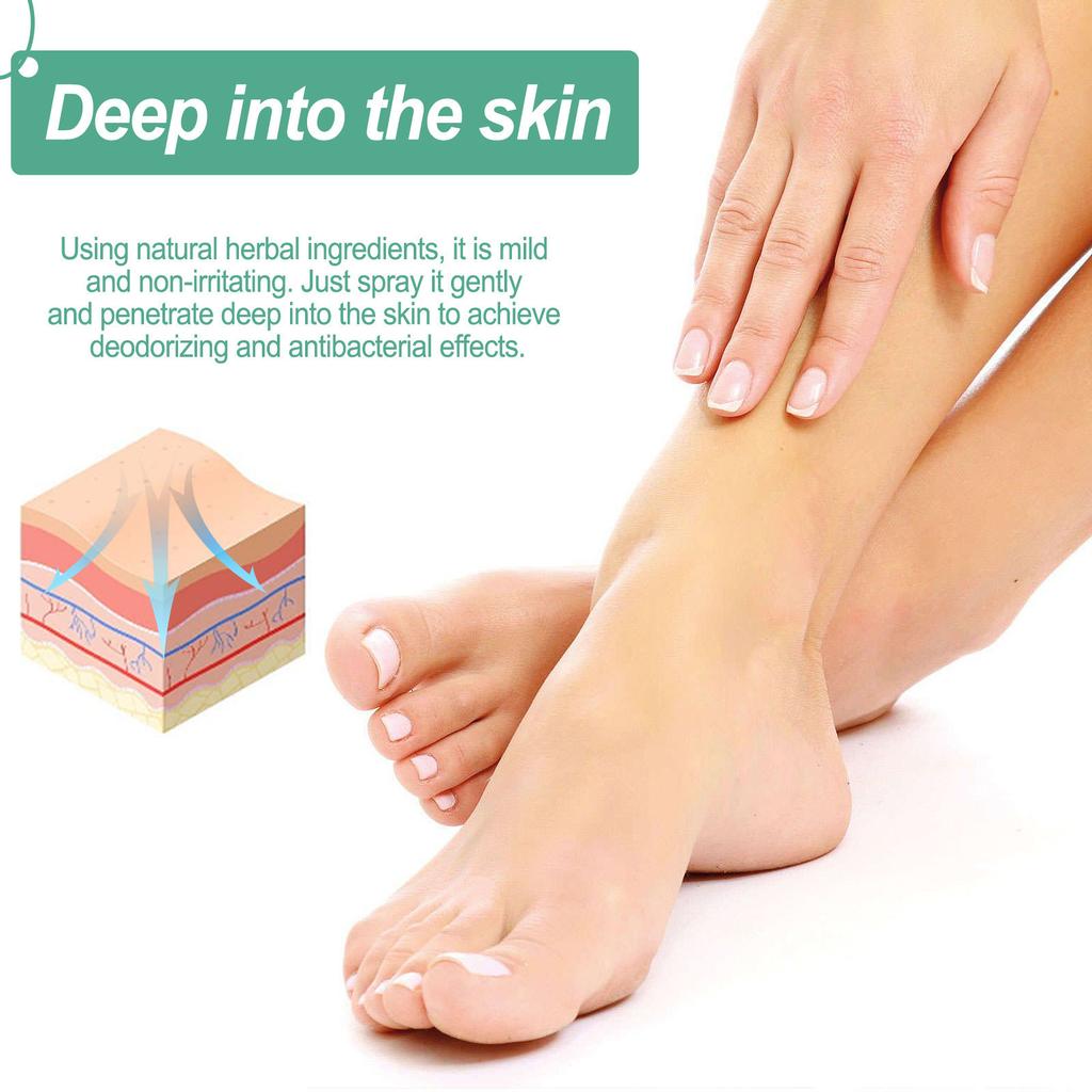 Athletes Foot Spray, Athletes Foot Fungi Spray, Foot Fungi Treating, Feet Smelly, Feet Itchy, Sweating, Peeling, Blisters,45ml