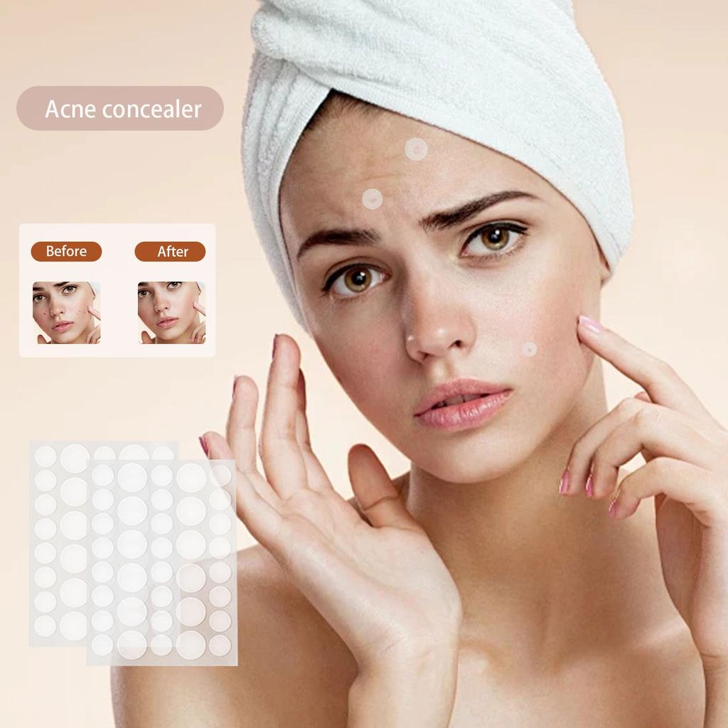 36 Acne Patch Концентрированный корректор от прыщей (инкапсулированный)