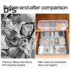 Transparent Data Cable Storage Box with Lid 5 Compartments Large Capacity Multi-purpose Charging Cord Jewelry Trinkets Organizer Case Container