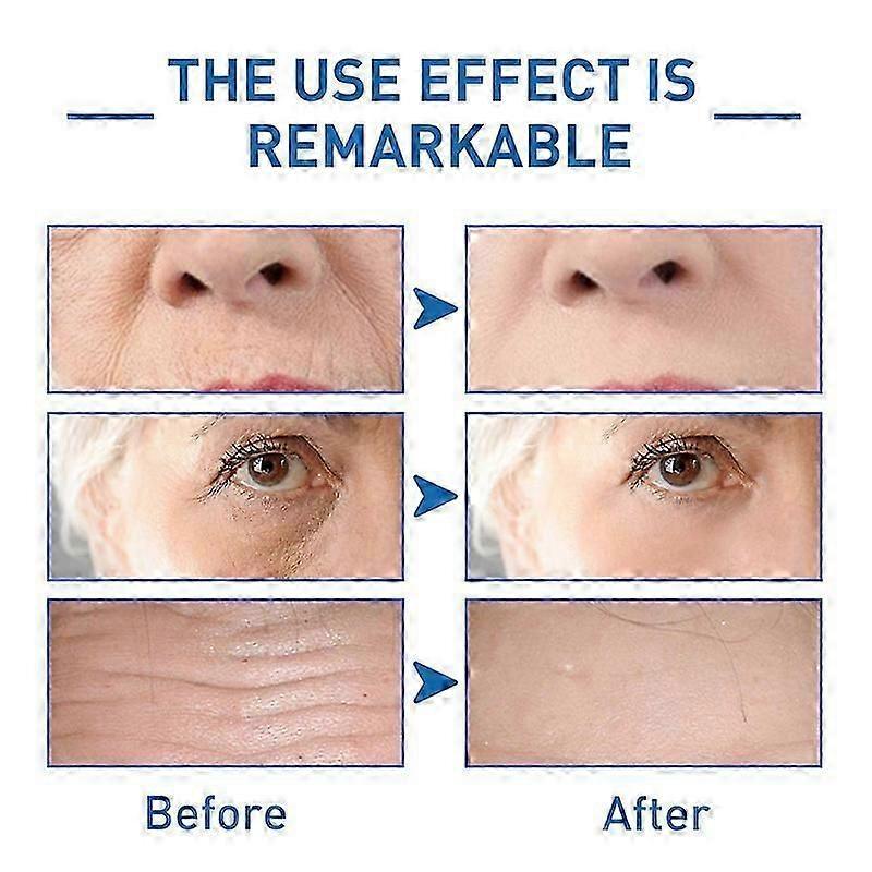 3 шт. Антивозрастная сыворотка Hyalu B5 Антиоксидантный концентрат Восстанавливающая 30 мл