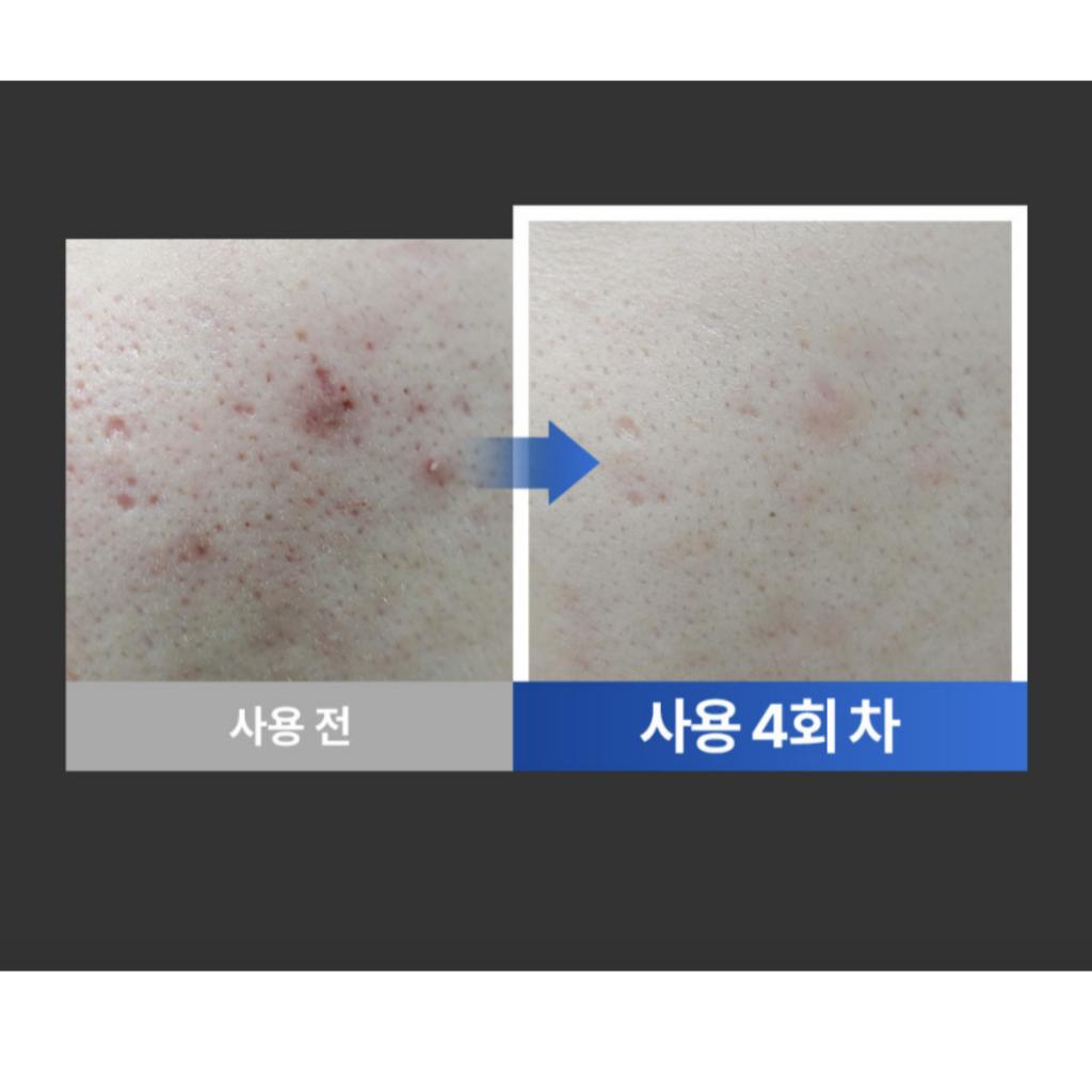 [DERMATHOD] Derma EZ Jet Multi Effector Ampoule 4ml MTS Home Care Set