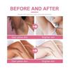 Intimate Dark Spot Remover for Body, Face, Bikini and Sensitive Areas - Intimate Areas