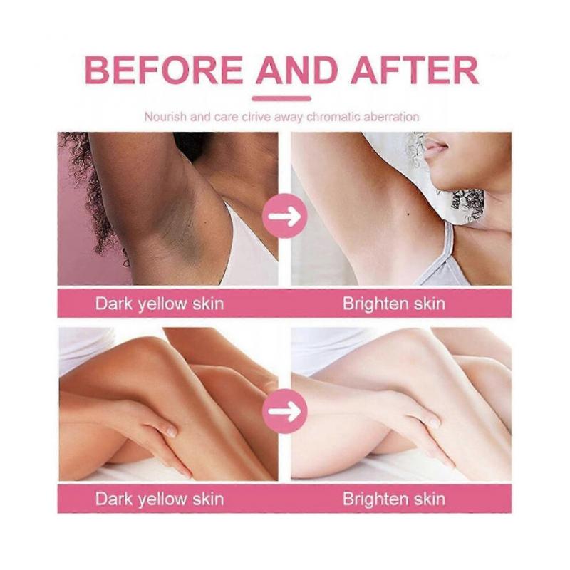 Intimate Dark Spot Remover for Body, Face, Bikini and Sensitive Areas - Intimate Areas