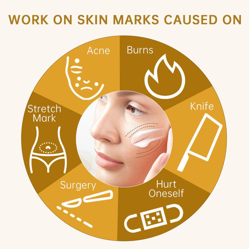 Shea Butter Scar Removal Cream Stretch Marks Treatment Sunburn Burns Old Scars Smoothing Whitening Cream Gel Body Face Skin Care