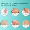 Silicone Scar Sheet Reusable Self-adhesive Breathable Waterproof Scar Removal Strip C-section Burns Acne Surgical Scar Treatment Tape