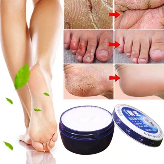 88g Anti Crack Moisturizing Hand Foot Cream Repairing Fissures Heal Ointment