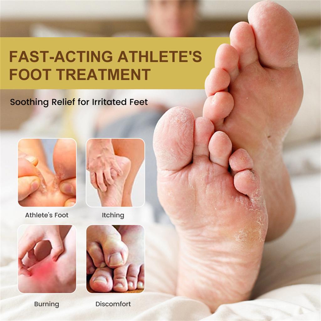 Athlete's Foot Care Balm 20 G Effectively Treats Foot Odor Itchy Feet Rotten Feet And Athlete's Foot And Moisturizes And Protects Dry Calloused Feet