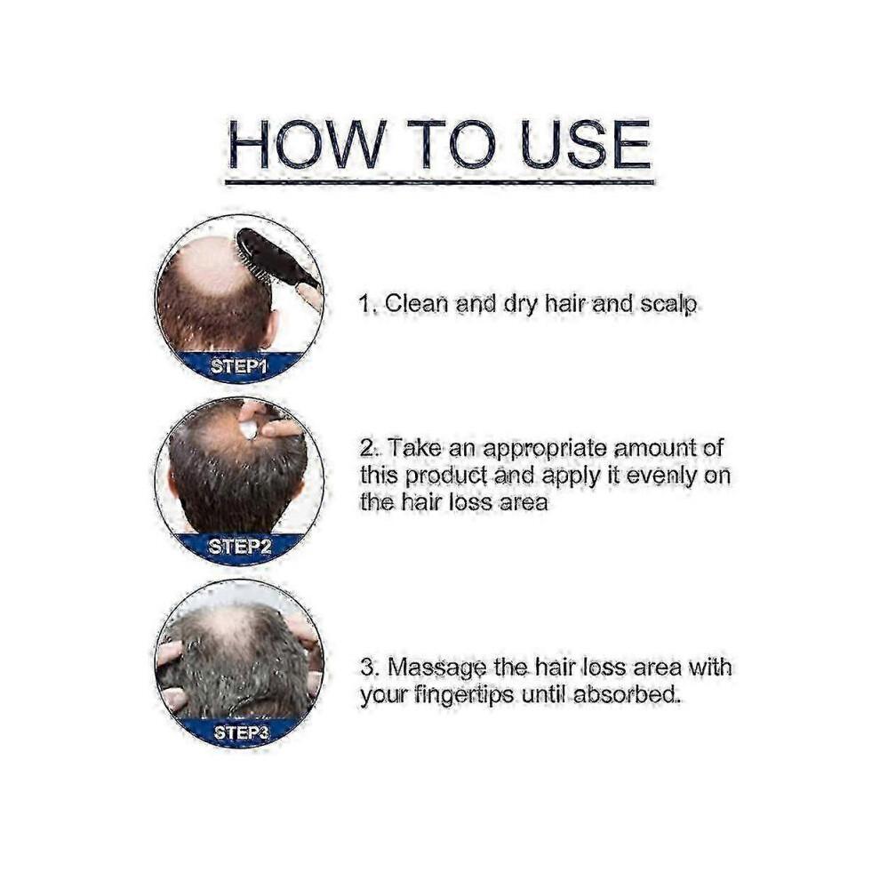 1-3X New Alopecia Treatment Cream Hair Growing Prevent Alopecia Baldness Regrowth 20g