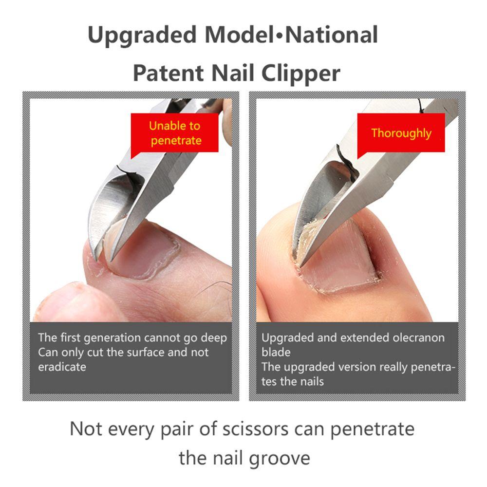 Tool Edge Cutter Trimmer Paronychia Clipper Nail Cutter Cuticle Scissor Toe Nail Cuticle Scissor