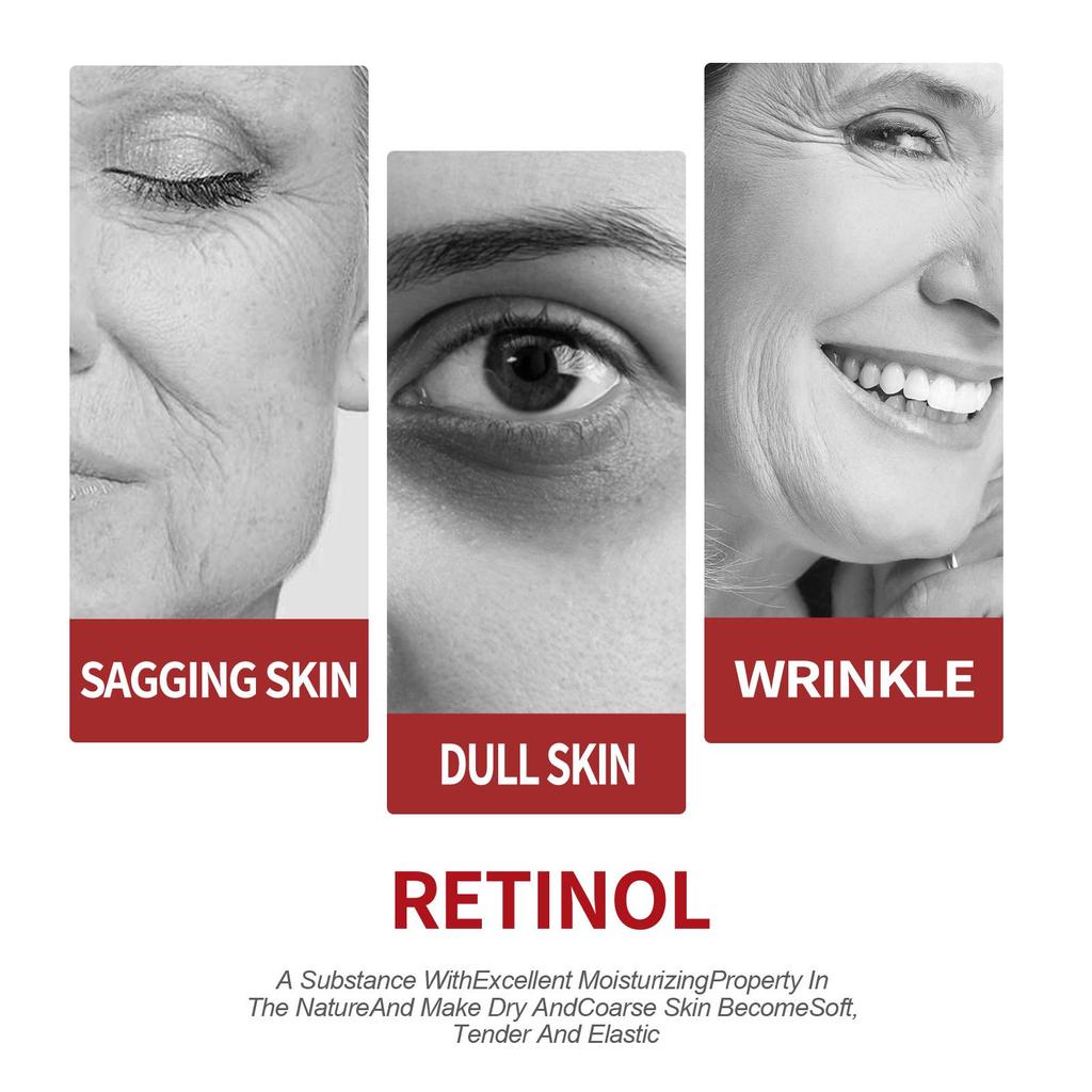 OUHOE Retinol Moisturizing Cream - Reduces Fine Lines and Dark Circles, Brightens and Whitens Skin, Firms, Moisturizes, for Face and Neck, 30g