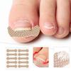 Ingrown Toenail Stickers