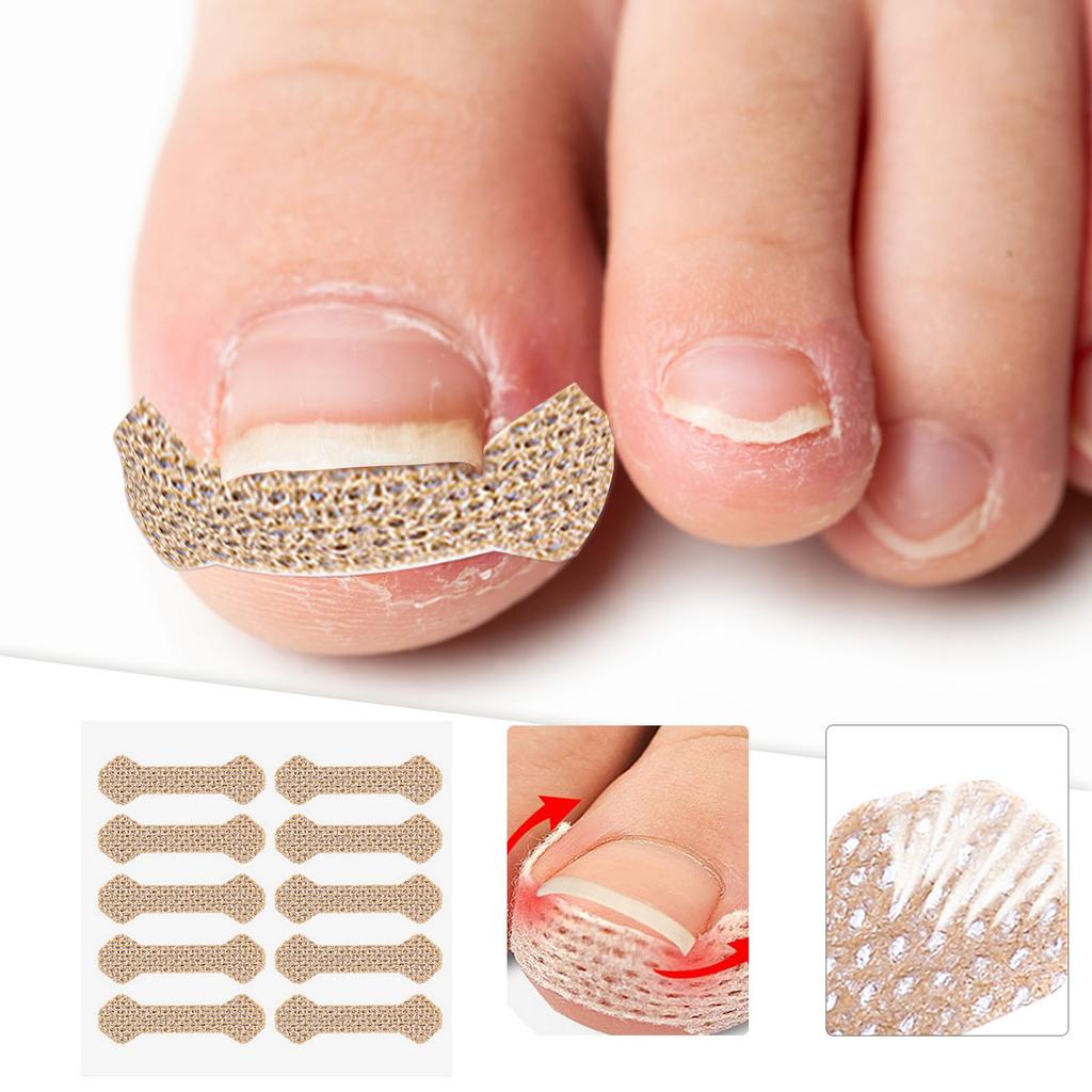Ingrown Toenail Stickers