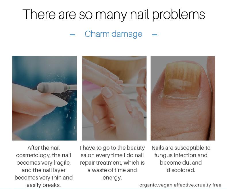 Nail Care Pen – Cuticle & Hangnail Remover, Softens & Strengthens Nails, Fungal Nail Care Treatment less
