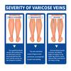 Varicose and Spider Veins Ease for Legs, Improve Blood Circulatio