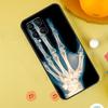 Чехол X-Ray Human Anatomy для Samsung Galaxy M54 M34 M14 M12 M32 M52 M53 M33 M13 M20 M21 M51 M15 M55 M31s M30s