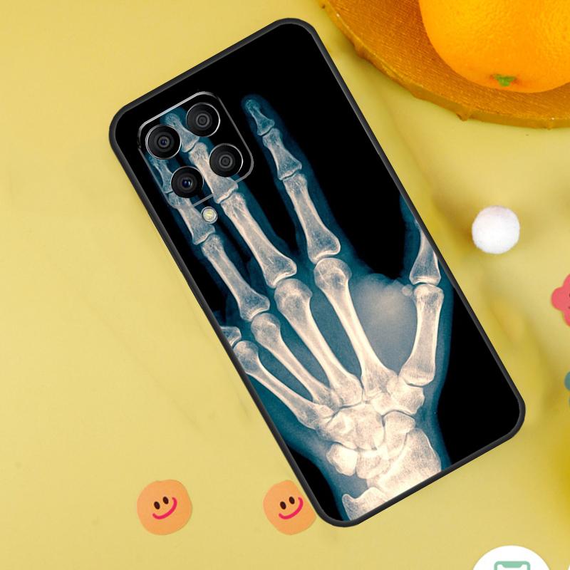 Чехол X-Ray Human Anatomy для Samsung Galaxy M54 M34 M14 M12 M32 M52 M53 M33 M13 M20 M21 M51 M15 M55 M31s M30s