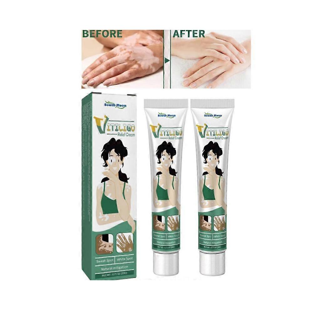 2pcs Vitiligo Skin Repair Cream,Vitiligo Treatment Cream, Dispose of White Spots on Skin and Improve Skin Pigmentation